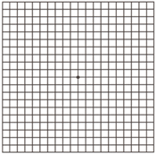 Appearance of Amsler Grid with Normal Vision